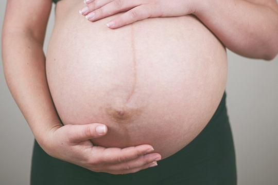 孕期为什么会长妊娠纹？如何去掉妊娠纹？
